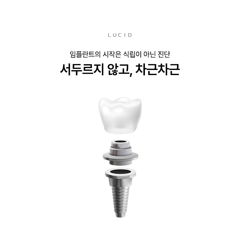 강남임플란트 심미성이 중요한 이유 관련 이미지 1
