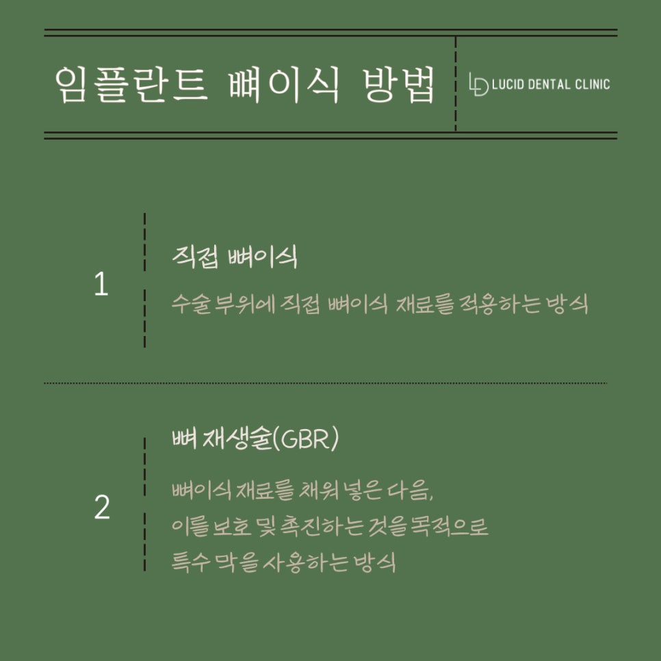 서초동 치과 임플란트 뼈이식 과정부터 재료, 주의 사항 한 번에 알려드리겠습니다! 관련 이미지 3