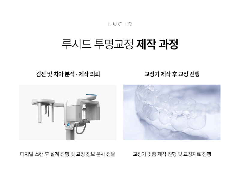 역삼역치과에서 투명교정, 누구에게 맞을까? 관련 이미지 6