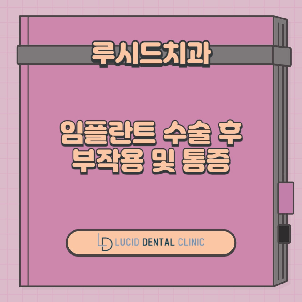역삼동 치과 임플란트 수술 후 부작용 및 통증 원인, 해결 방법은? 관련 이미지 9