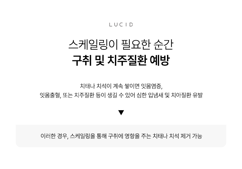 Everything About Scaling at Gangnam Station Dental Clinic image 3