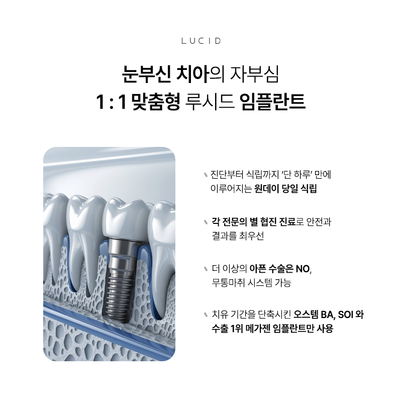 Why Choose Lucid Dental Clinic image 5