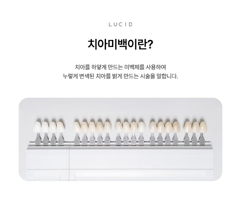 Gangnam Teeth Whitening: Where Should You Go to See Results? image 3