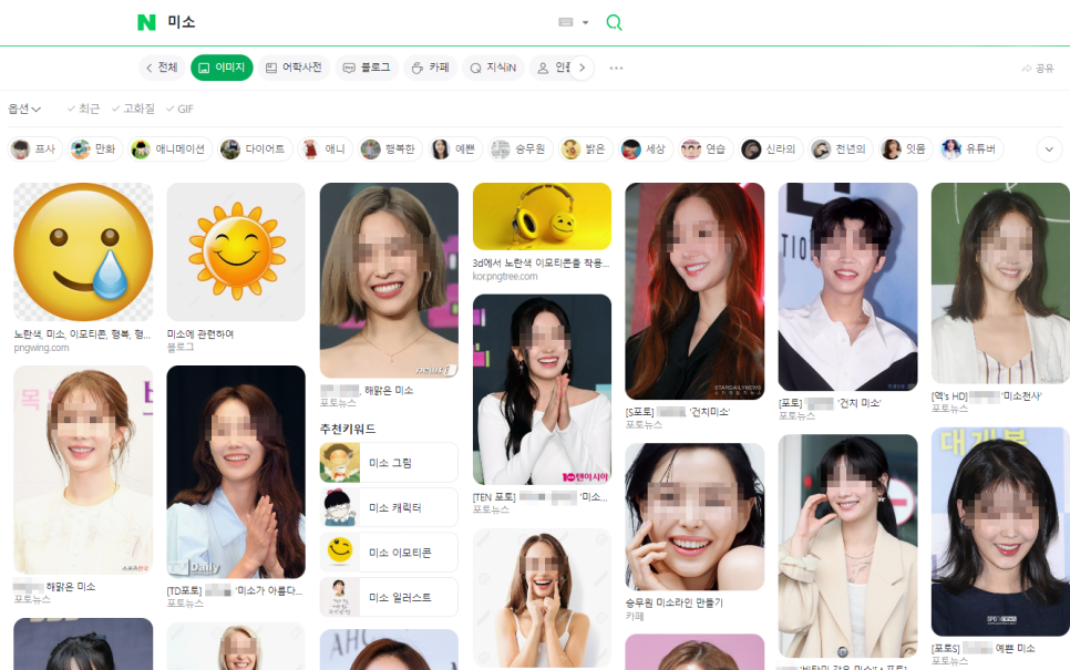 논현동 치과 에서 교정 없이, 라미네이트 시술 로 뻐드렁니 개선해 드린 사례 관련 이미지 1
