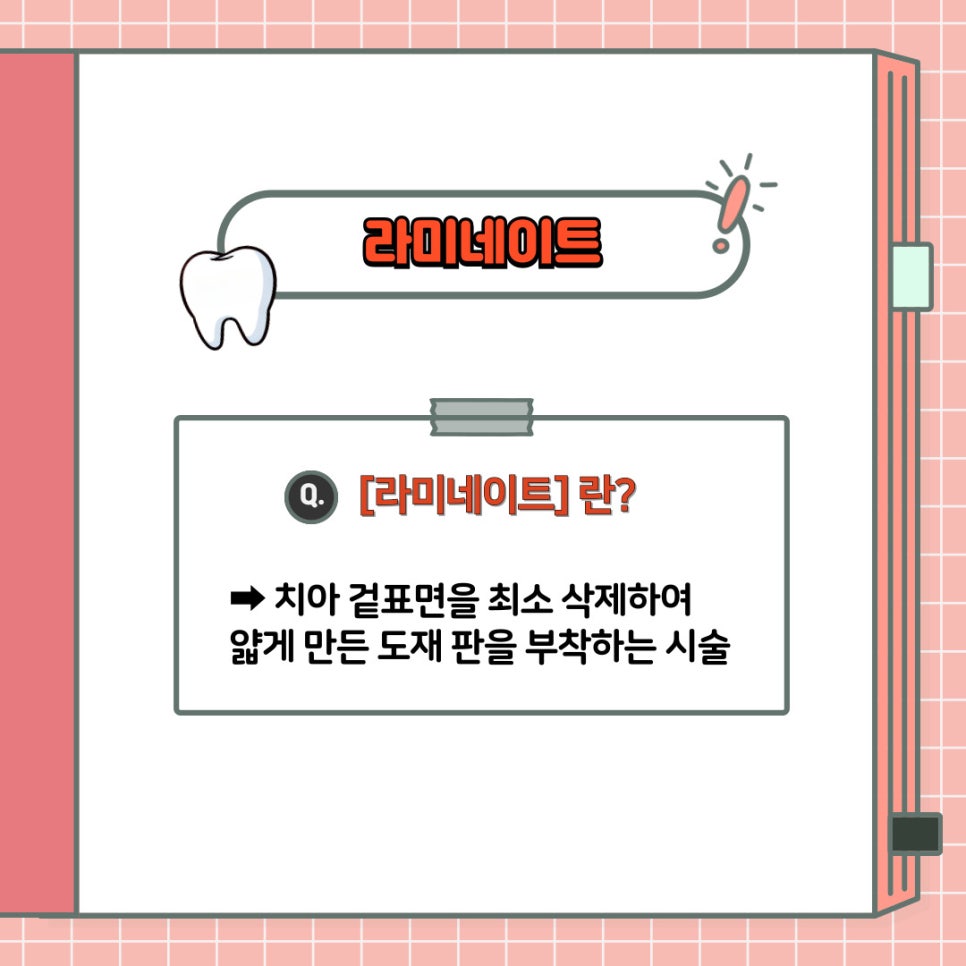 내 치아는 미백 VS 라미네이트 어떤 걸 받아야 될까? - 서초동 치과 의 구강 상식 소개 관련 이미지 7