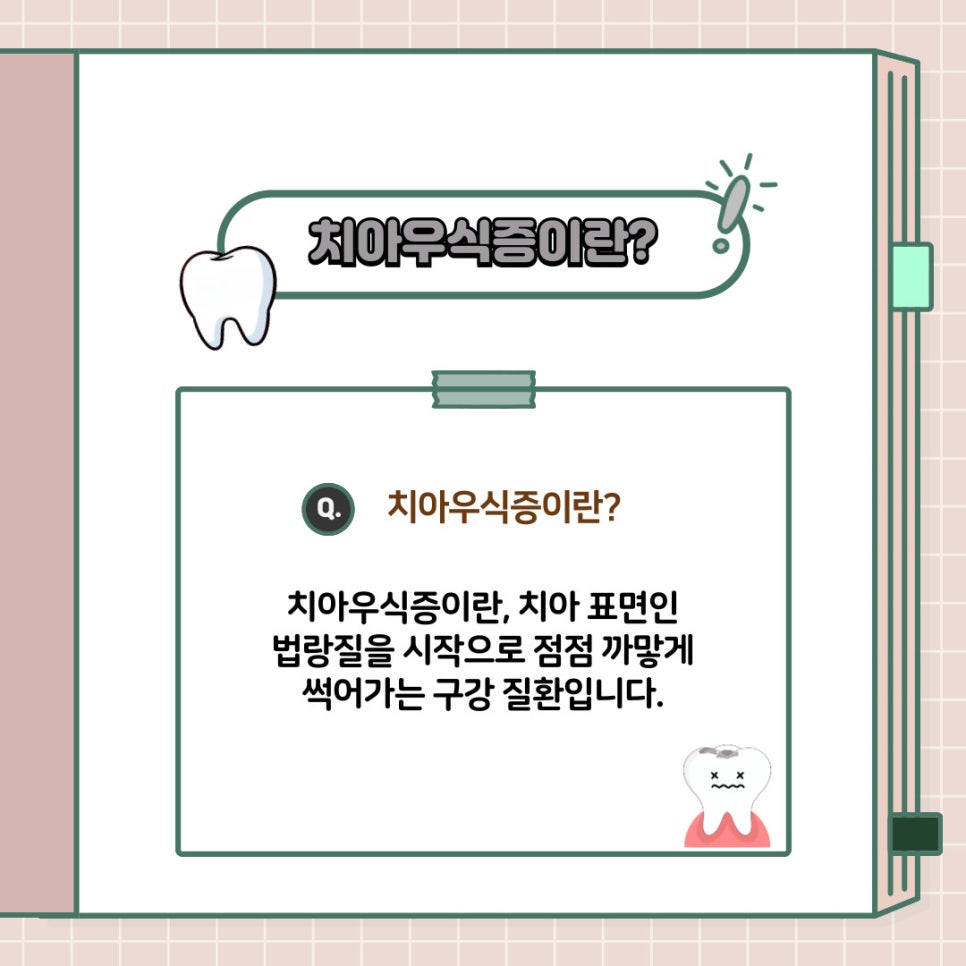 치아 충치 치료, 종류부터 과정까지 신논현역 치과 에서 알려드리겠습니다! 관련 이미지 3