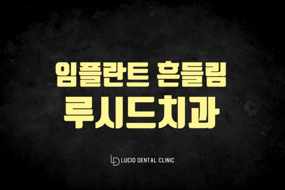 역삼역 치과 임플란트 흔들림 원인을 미리 파악하여 대처할 수 있어야 됩니다. 관련 이미지 4
