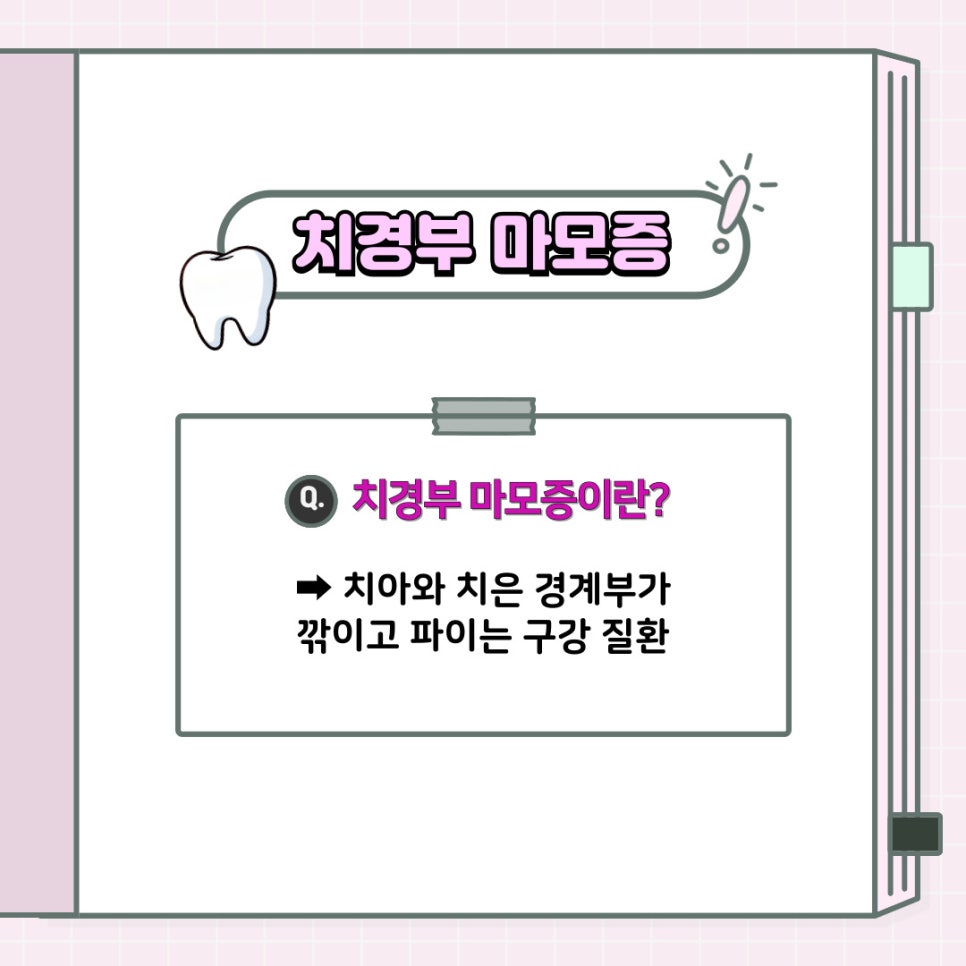"어금니 치아가 시려요!" 치아 시림, 알고 보니 치경부 마모증? - 강남역 치과 추천 관련 이미지 3