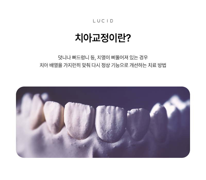Gangnam Orthodontic Treatment, from Cost to Final Maintenance image 2