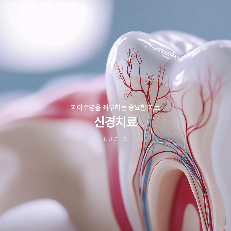If You’re About to Receive Root Canal Treatment at Seonjeongneung Station Dental Clinic image 1