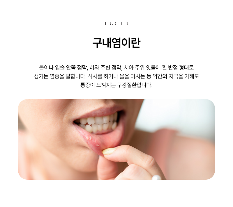 Do you keep getting mouth sores and stinging pain? Don’t put up with stomatitis any longer image 3