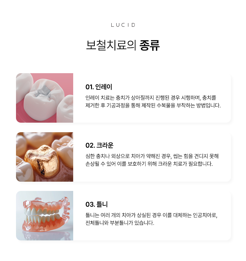 논현동치과 보철치료 전 알아두면 좋은 체크 포인트 관련 이미지 5