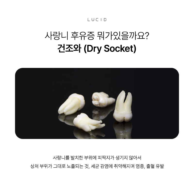 Essential Precautions After Wisdom Tooth Extraction for a Faster Recovery at a Nonhyeon-dong Dental Clinic image 3