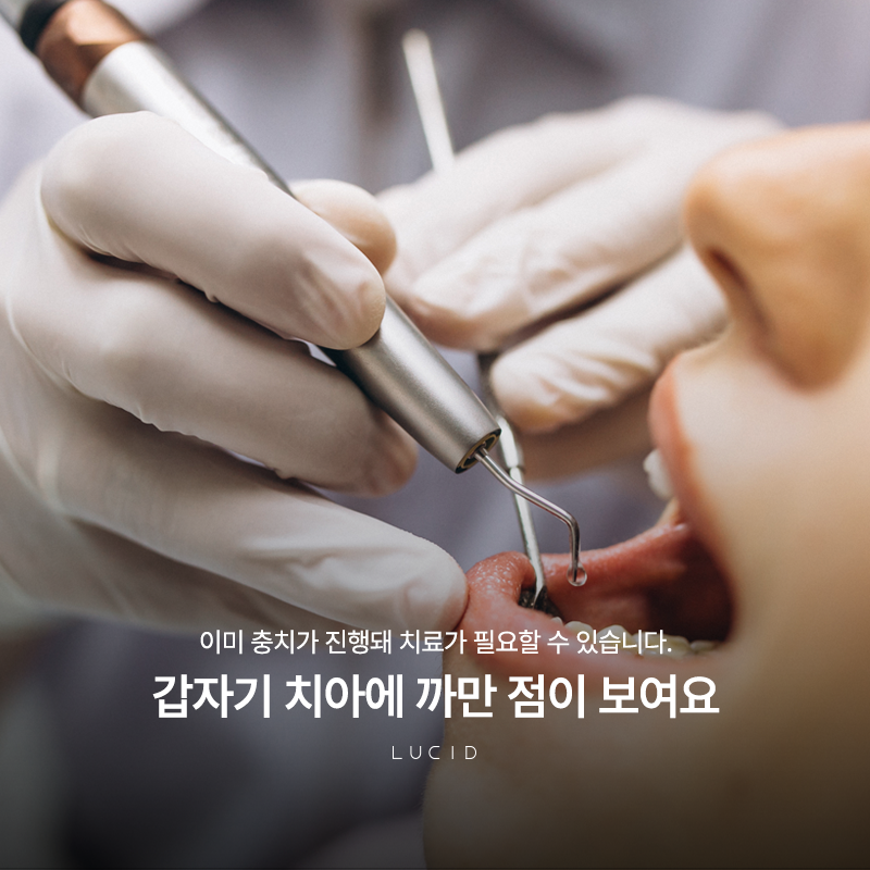Cavity Treatment: Is It Always Anxiety-Provoking and Scary? image 2