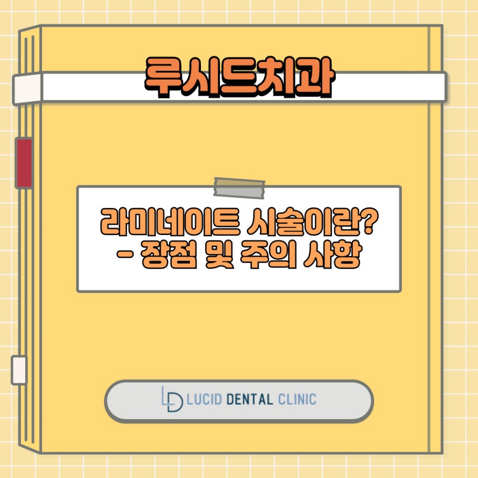 앞니 라미네이트 란? 과정 및 방법, 여기에 주의 사항까지 강남역 치과 에서 모두 알려드리겠습니다! 관련 이미지 5