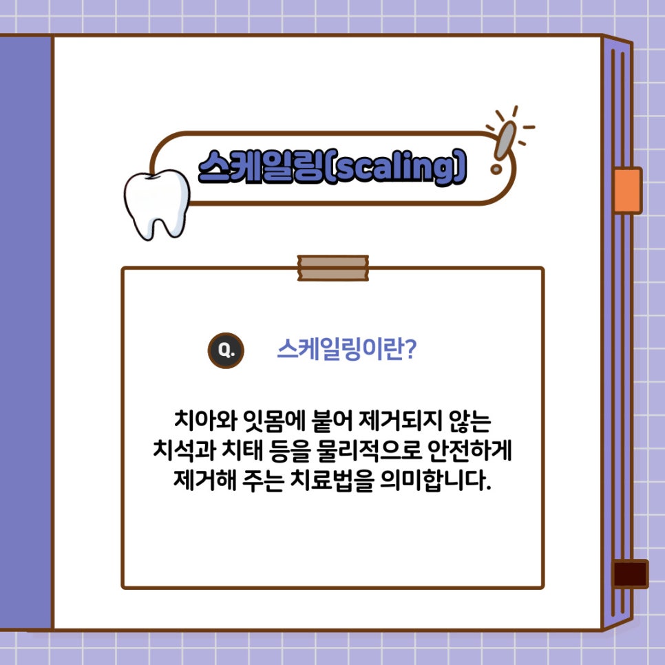 역삼동 치과 에서 알려주는 스케일링, 구강 관리의 중요성 - 이제 우리 스스로 지킵시다! 관련 이미지 3