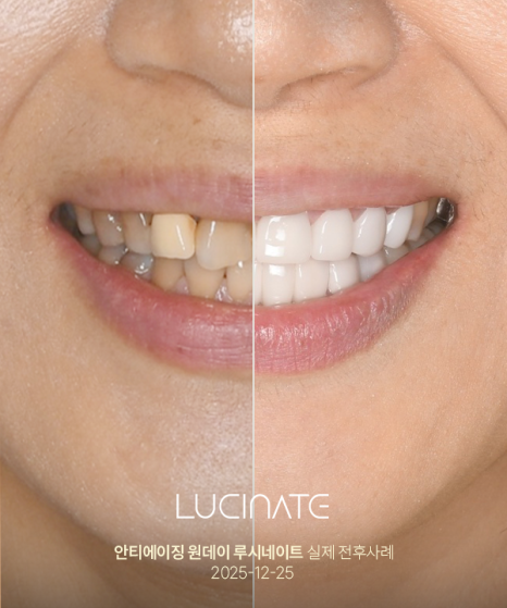 Gangnam Dental Clinic Lucinate for a Younger Smile image 3