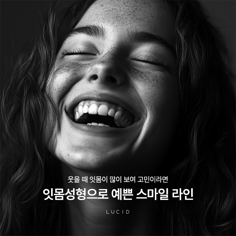 Gangnam dental clinic gum contouring: In what cases is it needed? image 2