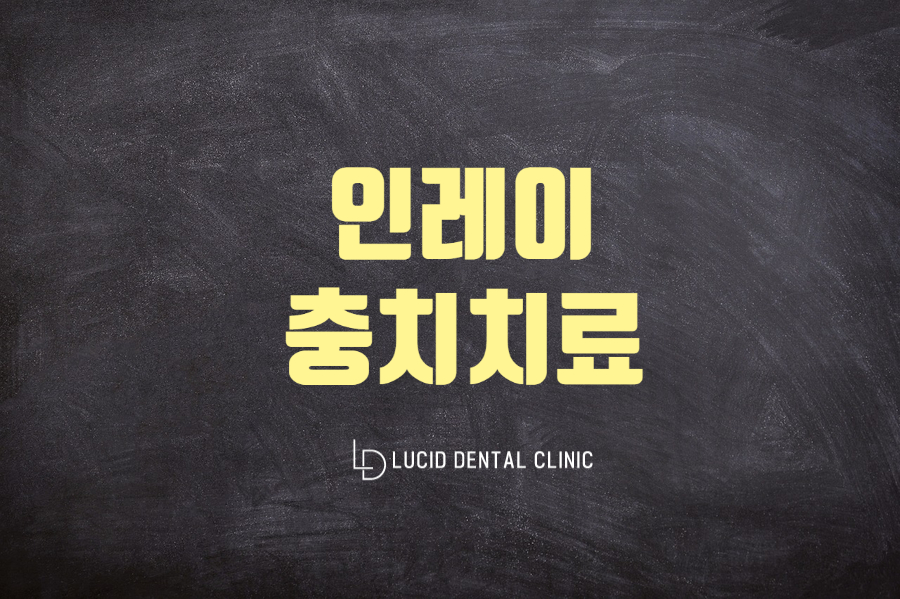 강남역 충치치료 루시드 치과 에서 인레이에 관해 알려드립니다 관련 이미지 1