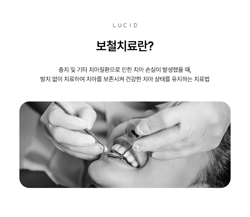 Do You Know About Prosthetic Treatment, a Way to Replace Missing Teeth? image 2