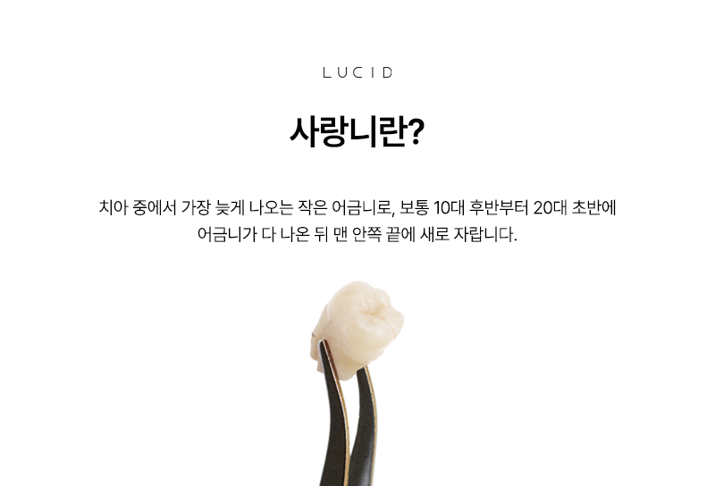 강남역 근처 치과 사랑니발치 후 운동 가능한 시점 관련 이미지 2