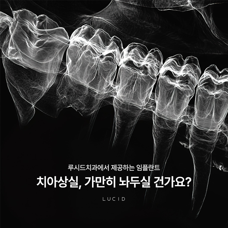 Where Should You Get an Implant Near Gangnam Station? image 2
