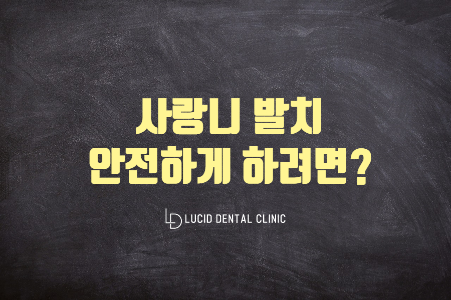 언주역 사랑니발치 어떤것을 고려해서 뽑아야 될까요? 루시드에서 알려드립니다 관련 이미지 1