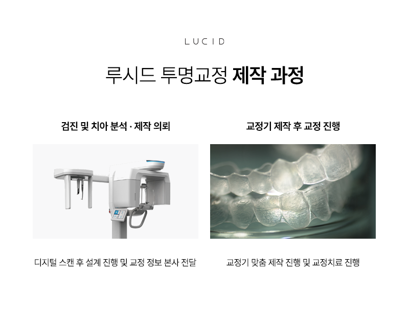 선릉역치과 성인 치아교정, 투명교정 관련 이미지 5