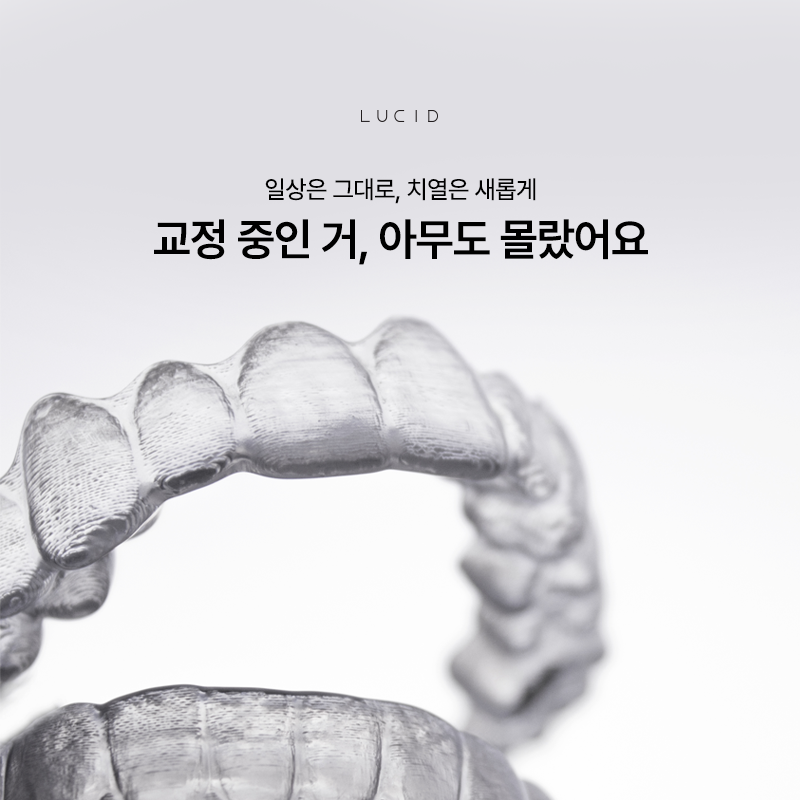 Lucid Dental Clinic Clear Aligners, a Choice with Reason image 2