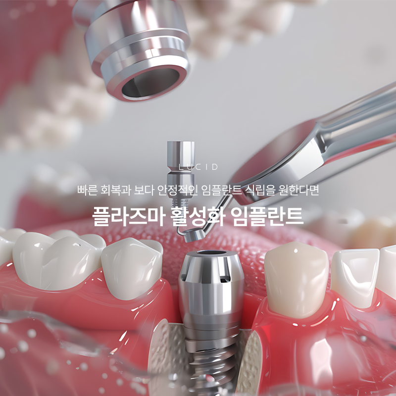 Why Plasma Implants Are Said to Recover Faster at Nonhyeon-dong Dental Clinic image 1