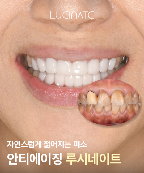 Gangnam Dental Clinic Lucinate for a Younger Smile image 2