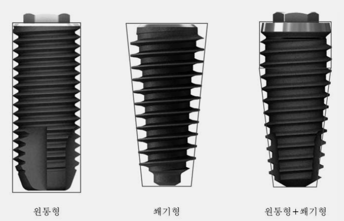 임플란트 초기 고정력, 왜 중요할까? 신논현역 치과 에서 알려드리겠습니다! 관련 이미지 6