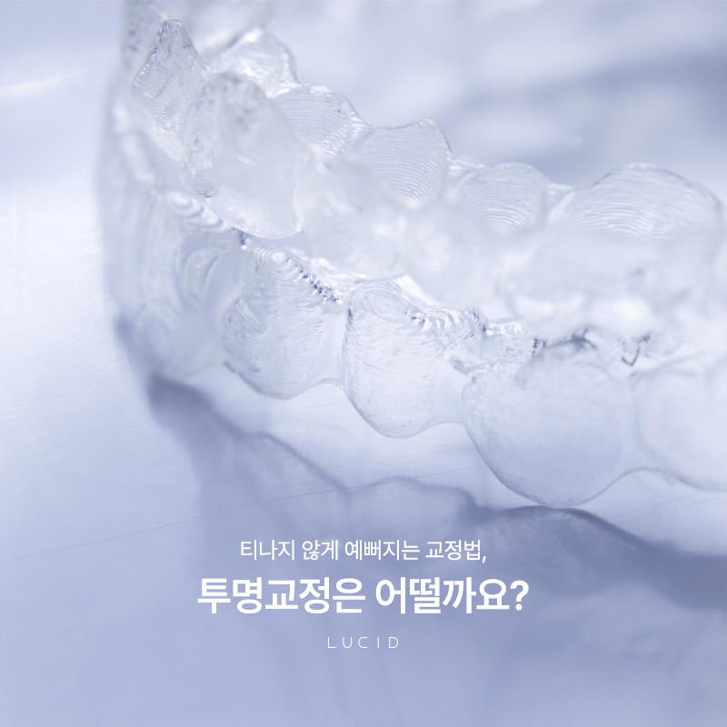 Yeoksam-dong Dental Clinic: If You Don’t Want Noticeable Orthodontic Treatment image 2