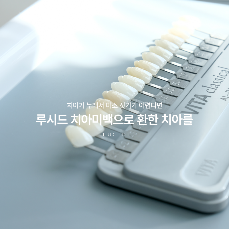 Seocho-dong Dental Clinic: From the Causes of Tooth Staining to Teeth Whitening Procedures image 2
