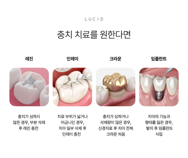 Smart Habits to Prevent Cavities image 6