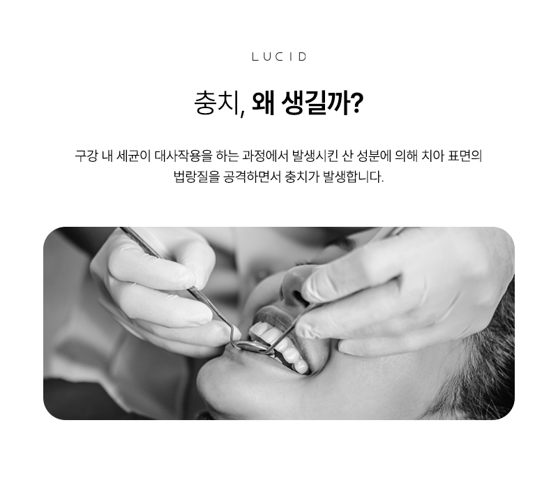 Tooth Decay Treatment: When and How Should You Get It? image 3