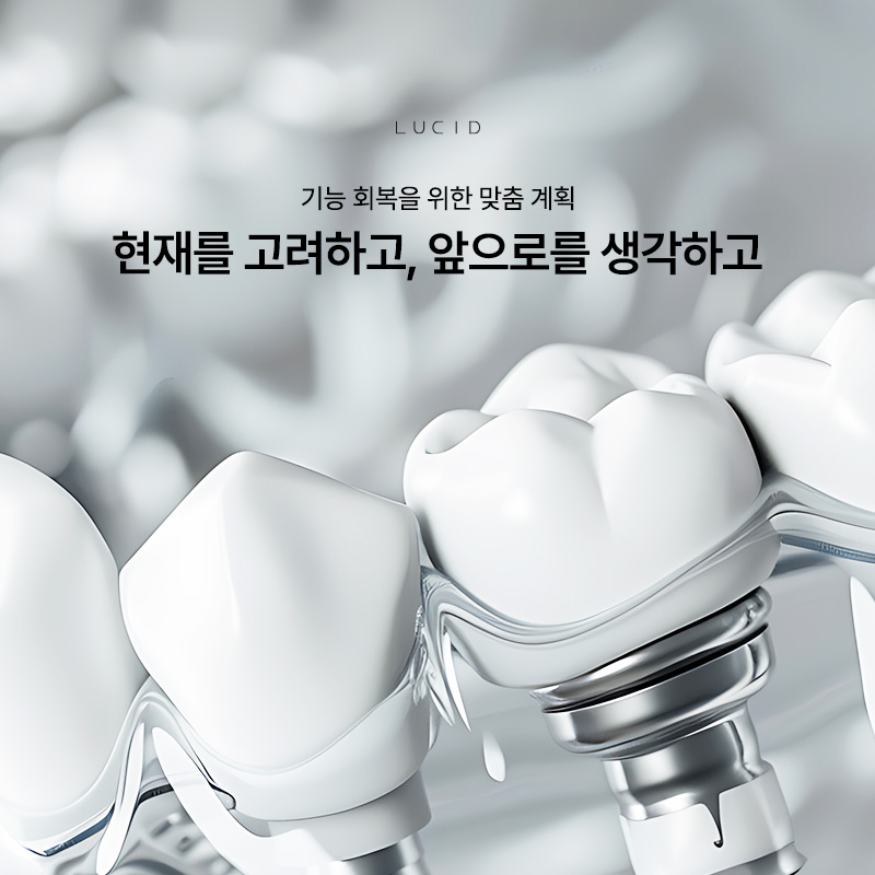 When Should You Get a Gangnam Dental Implant? What Matters More Than Price image 1
