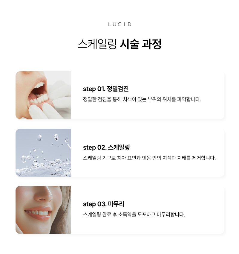 The First Step in Dental Health: Scaling image 4