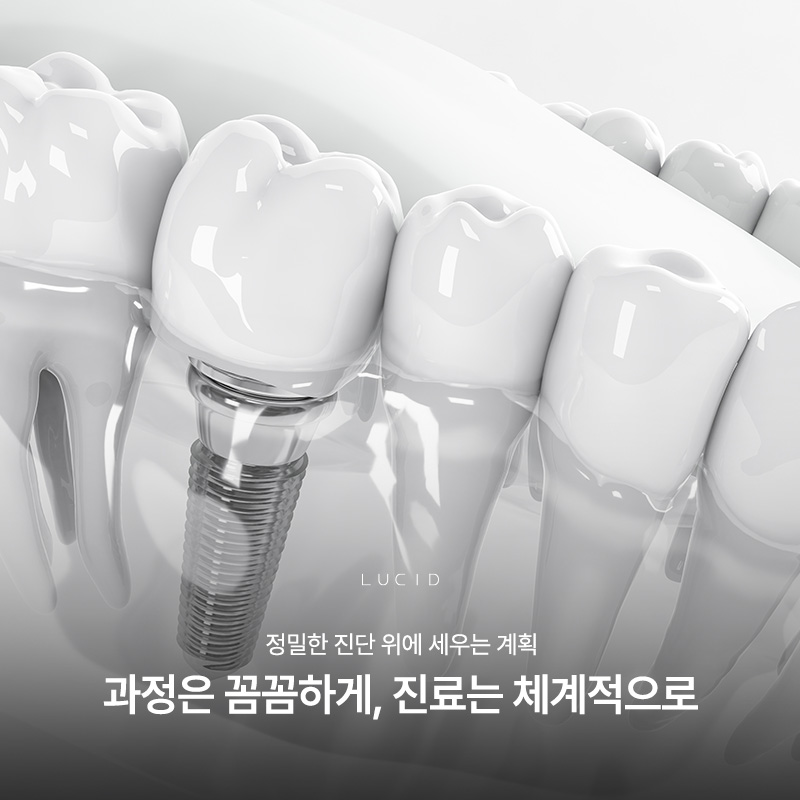 강남역임플란트추천 비용보다 중요한 것은 따로 있습니다 관련 이미지 1