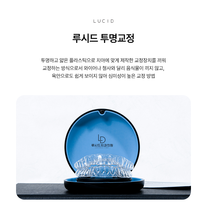 Yeoksam-dong Dental Clinic: If You Don’t Want Noticeable Orthodontic Treatment image 3