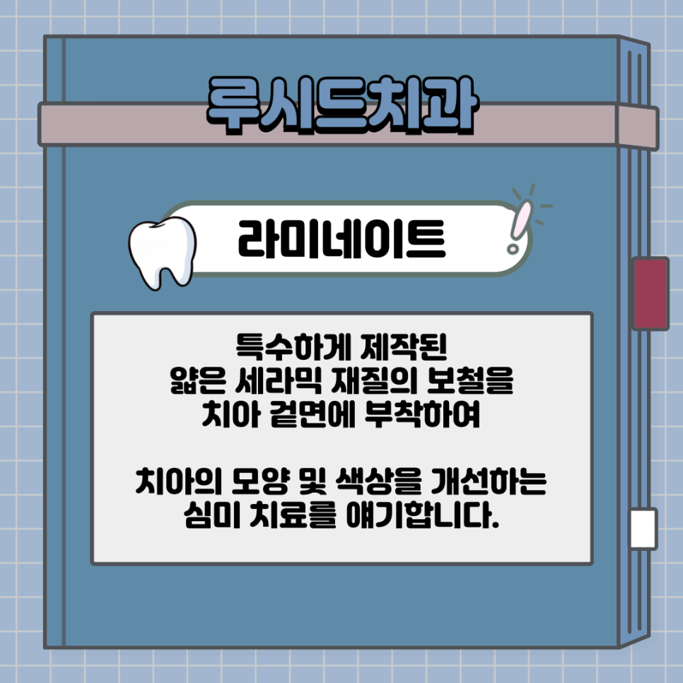 라미네이트 시술, 무삭제로 받을 수 있을까요? - 역삼역 치과 루시네이트 관련 이미지 4