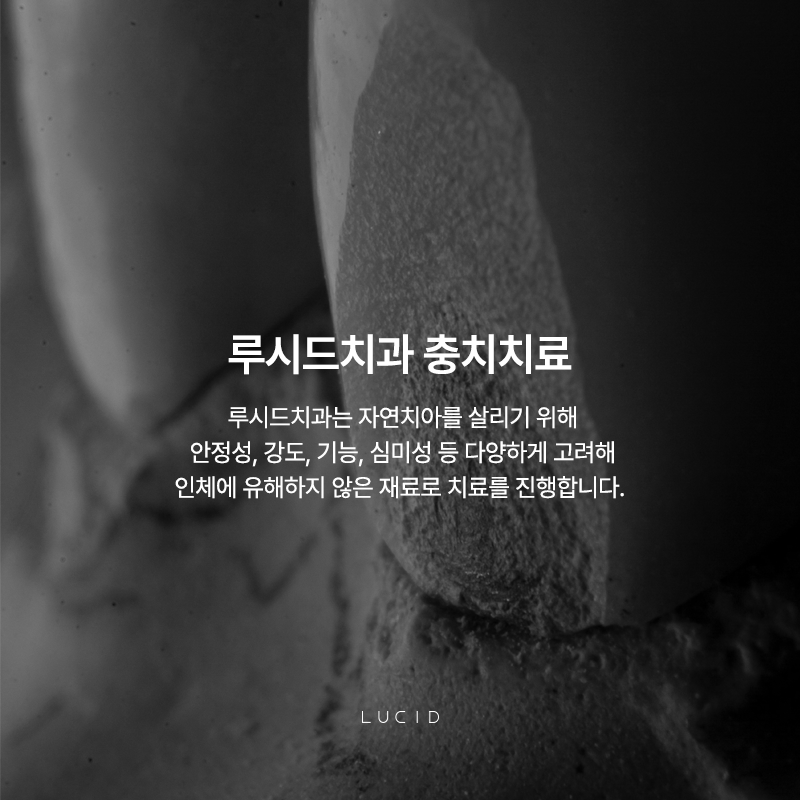 Nonhyeon-dong Cavity Treatment Starts with a Clear Understanding image 2