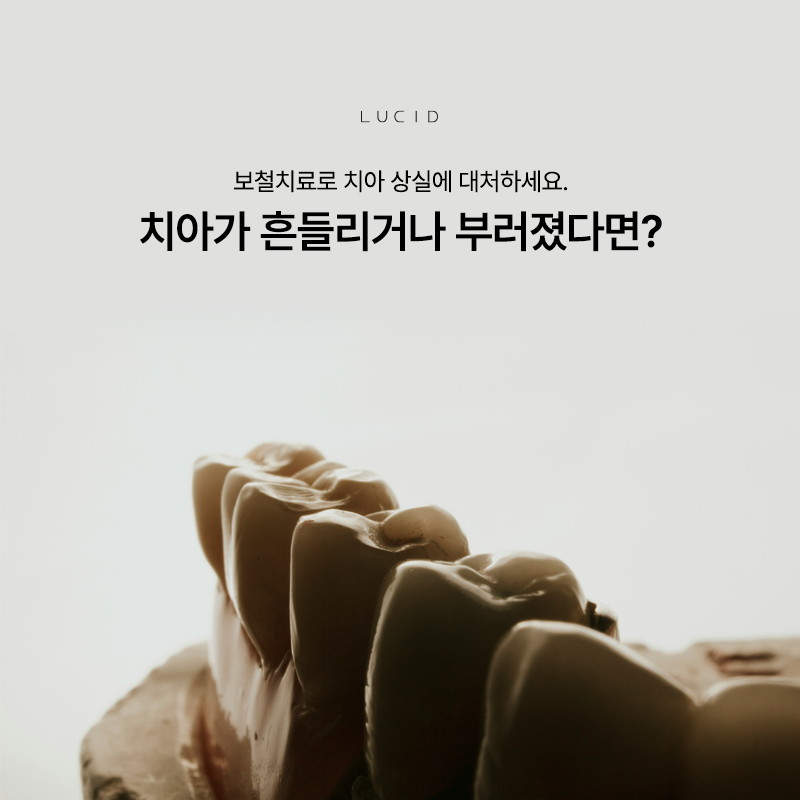 논현동치과 보철치료 전 알아두면 좋은 체크 포인트 관련 이미지 1