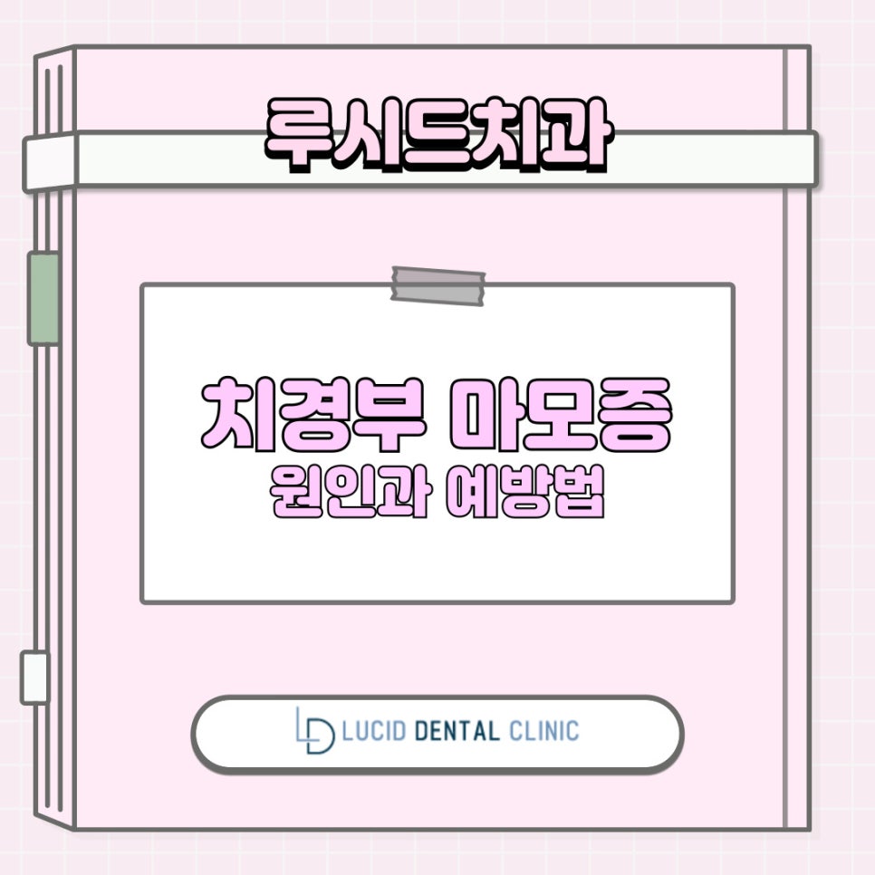 "어금니 치아가 시려요!" 치아 시림, 알고 보니 치경부 마모증? - 강남역 치과 추천 관련 이미지 8
