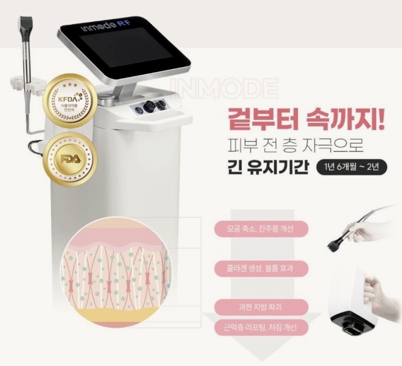 목동인모드 몇 회 받아야 하나요? 횟수보다 더 중요한 관련 이미지 2