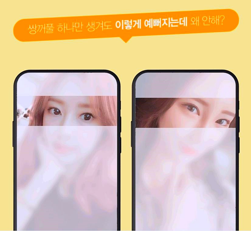 오목교쌍수 잘 하는 곳에서 알려주는 절개, 매몰 선택법 관련 이미지 1