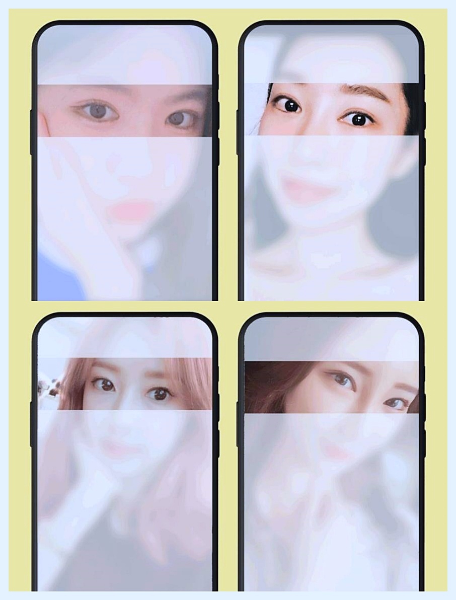 목동쌍수 매몰vs절개 방학때 하기 좋은 수술방법 따로 있나요? 관련 이미지 2