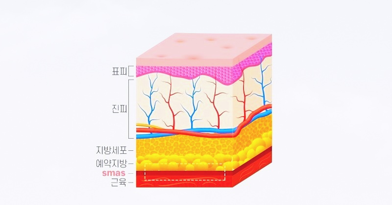 목동거상술 성형외과 전문의 맞춤 진료 하는 곳 관련 이미지 1