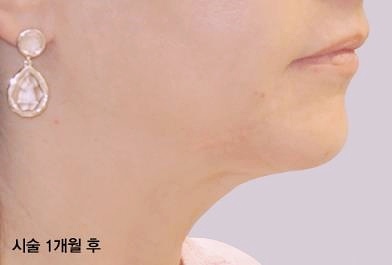 목동인모드 잘하는 곳 찾는다면 관련 이미지 2