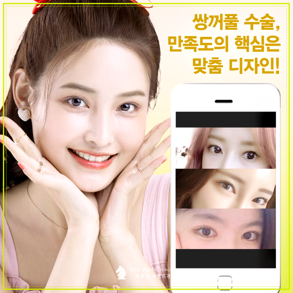 김포쌍수 인라인 vs 아웃라인 나에게 어울리는 라인 찾는 법 관련 이미지 2